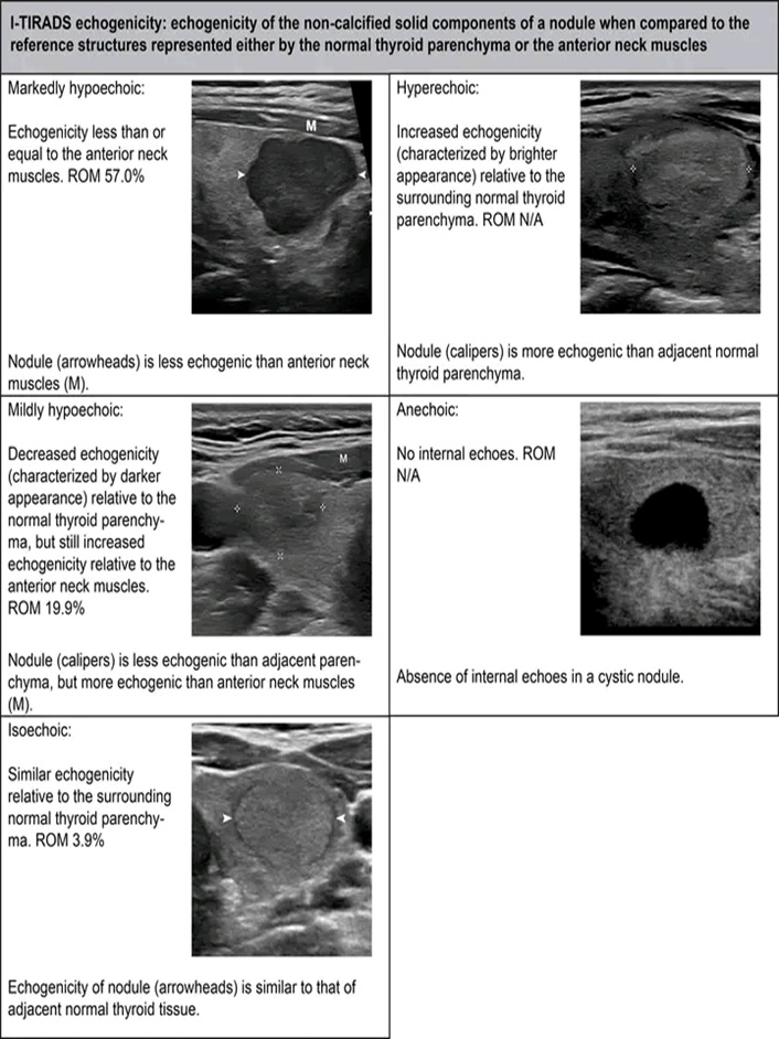 THYROID SONOGRAPHIC FEATURES 1