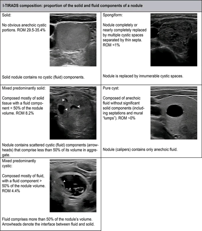 THYROID SONOGRAPHIC FEATURES 2
