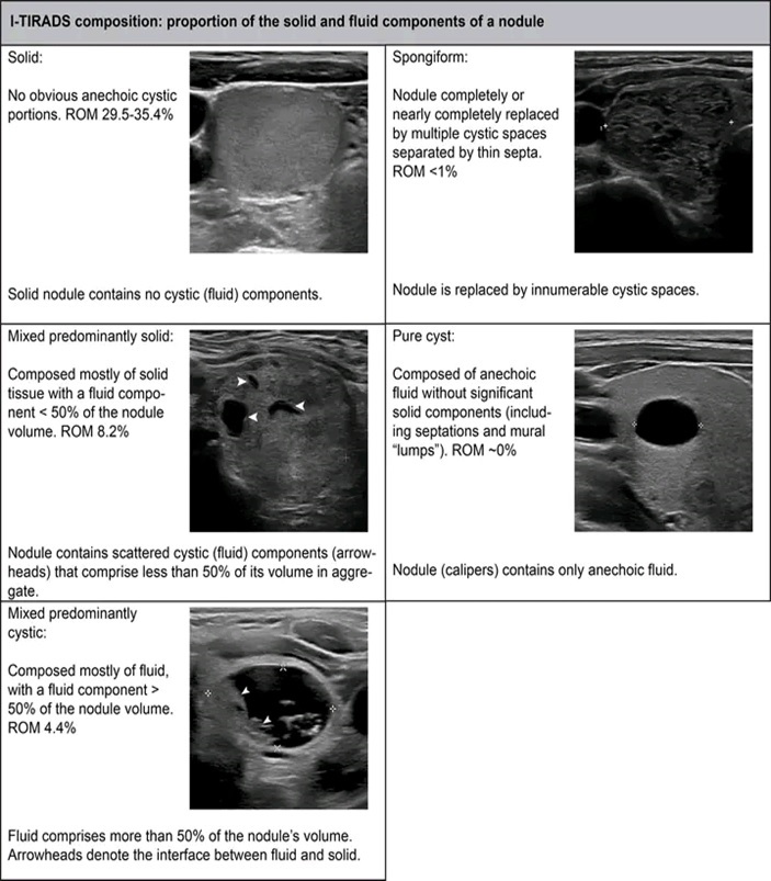THYROID SONOGRAPHIC FEATURES 3