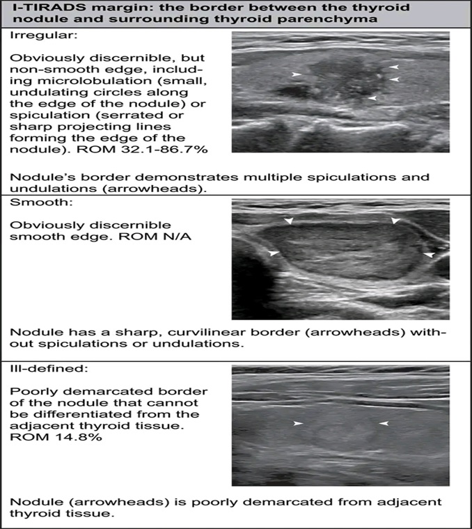 THYROID SONOGRAPHIC FEATURES 4