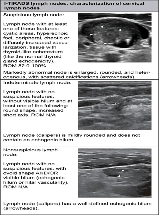 THYROID SONOGRAPHIC FEATURES 6