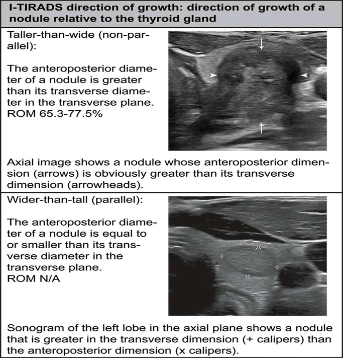 THYROID SONOGRAPHIC FEATURES 7